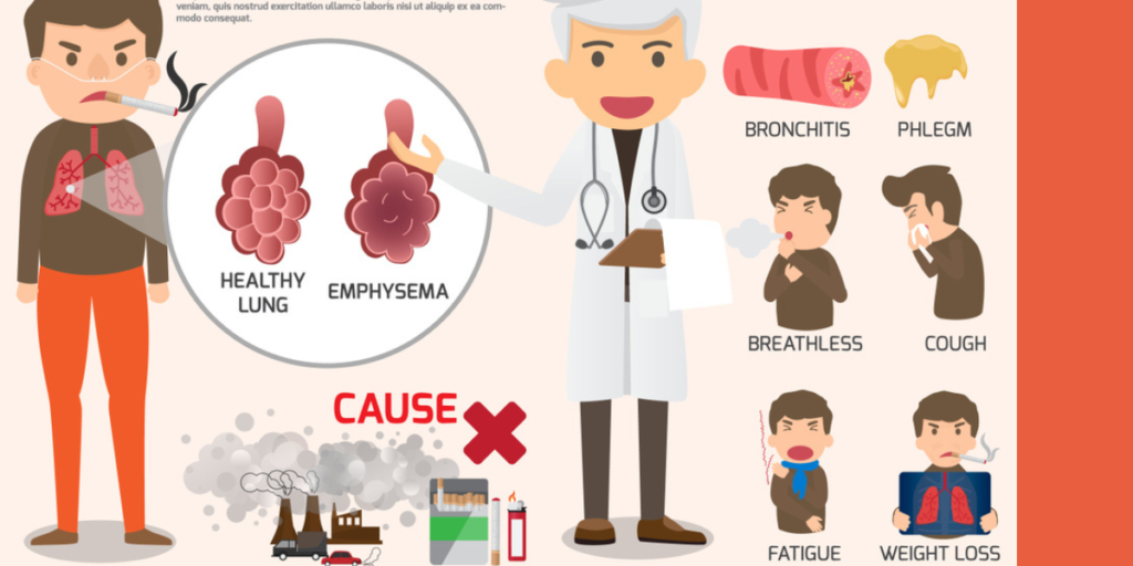 EMPHYSEMA: CAUSES, SYMPTOMS, AND TREATMENT