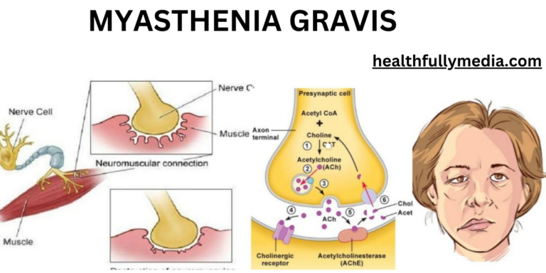 MYASTHENIA GRAVIS: A COMPREHENSIVE OVERVIEW OF SYMPTOMS, CAUSES, AND TREATMENT